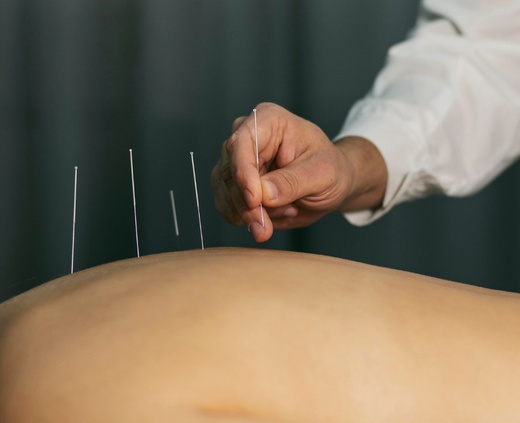 Отделение рефлексотерапии